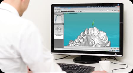 STL File 3D Printing