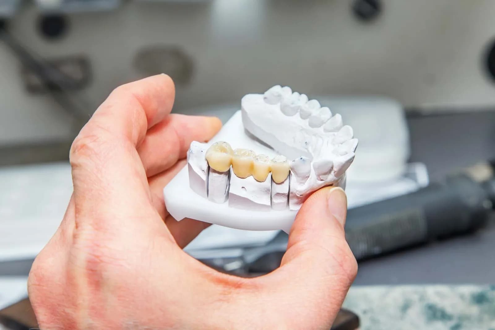 Dental bridge model