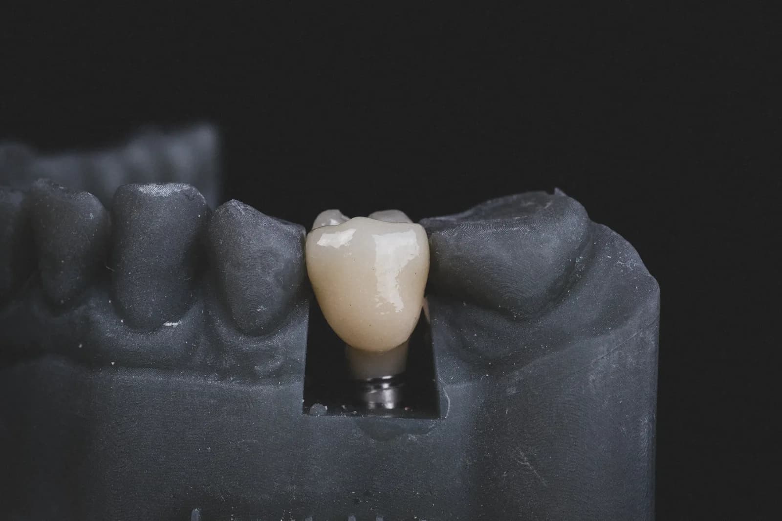 Single restorative implant