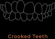 Crooked Teeth