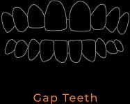 Gap Teeth
