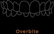 Overbite