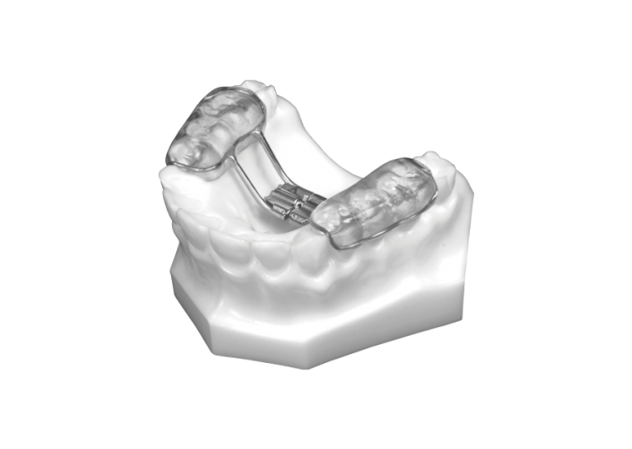 Bonded RPE (Upper Only)