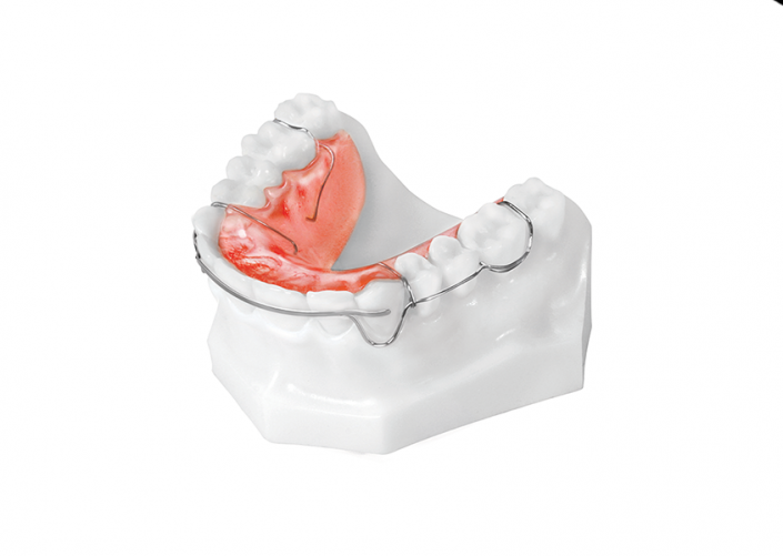 Circumferential Flat Bow (Upper)