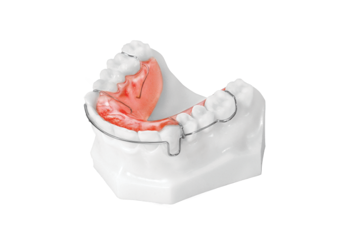 Circumferential Retainer (Upper)